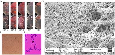 Unveiling metabolo-genomic insights of potent antitumoral and antibiotic activity in Streptomyces sp. VB1 from Valparaíso Bay